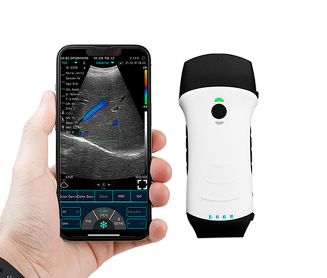 Sonda dual 3-en-1 ultrasónica Multiuso convexa + lineal + escaner cardíaco