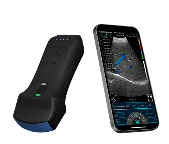 Sonda dual 3-en-1 ultrasónica Multiuso convexa + lineal + escaner cardíaco